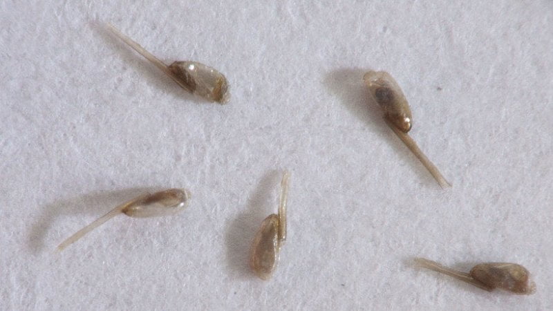 Multiple nits close up on hair
